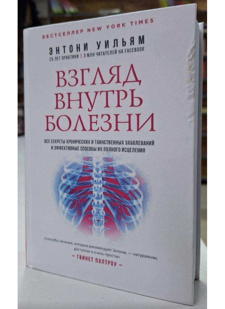 Взгляд внутрь болезни. Все секреты хронических и таинственных заболеваний (УЦЕНКА)